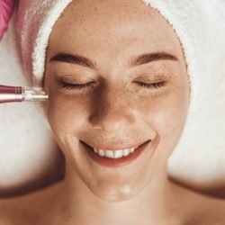 Microneedling Edmonton